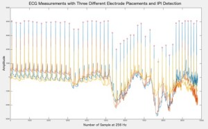 Rushanan ECG Graph